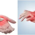 dormencia nas maos