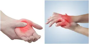 dormencia nas maos