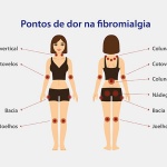 fibromialgia