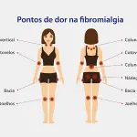 fibromialgia