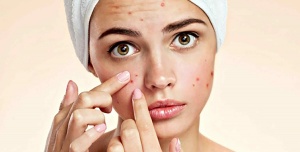 tratar e prevenir acne