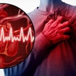 ataque cardiaco