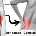 dor ciática