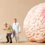 alzheimer