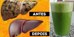 doença do fígado gordo