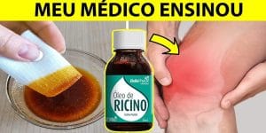 óleo de rícino
