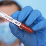 distúrbios na tireoide